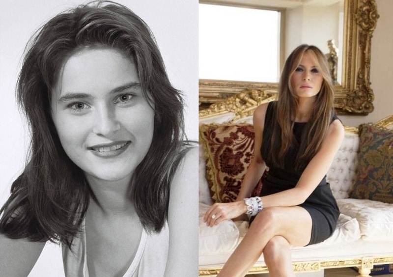 Мелания трамп фото в молодости до и после пластики фото
