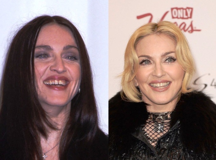 Голливудские улыбки до и после - 4